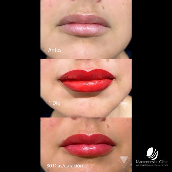 La micropigmentaci&oacute;n de labios permite lucir una boca elegante y perfectamente dise&ntilde;ada