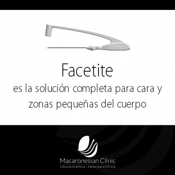 FaceTite es una soluci&oacute;n de moldeado m&iacute;nimamente invasiva para el rostro y zonas peque&ntilde;as del cuerpo.
